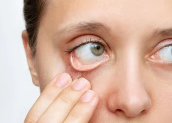 Dấu hiệu bệnh ở cơ mắt cần thăm khám