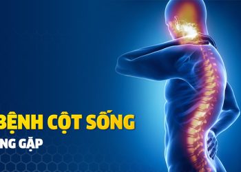 Dấu hiệu bệnh ở cột sống cần thăm khám