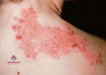 Dấu hiệu bệnh ở da cần thăm khám kịp thời