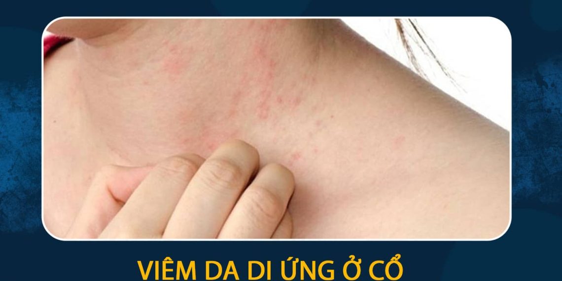 Dấu hiệu bệnh ở da cổ bạn nên biết