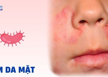 Dấu hiệu bệnh ở da mặt cần thăm khám