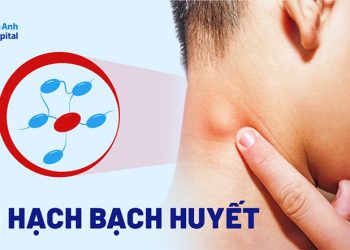 Dấu hiệu bệnh ở hệ bạch huyết bạn nên biết