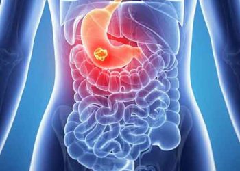 Dấu hiệu bệnh ở hệ tiêu hóa dễ bị nhầm lẫn