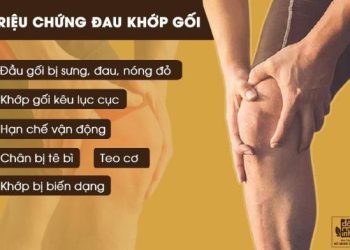 Dấu hiệu bệnh ở khớp gối dễ bị nhầm lẫn
