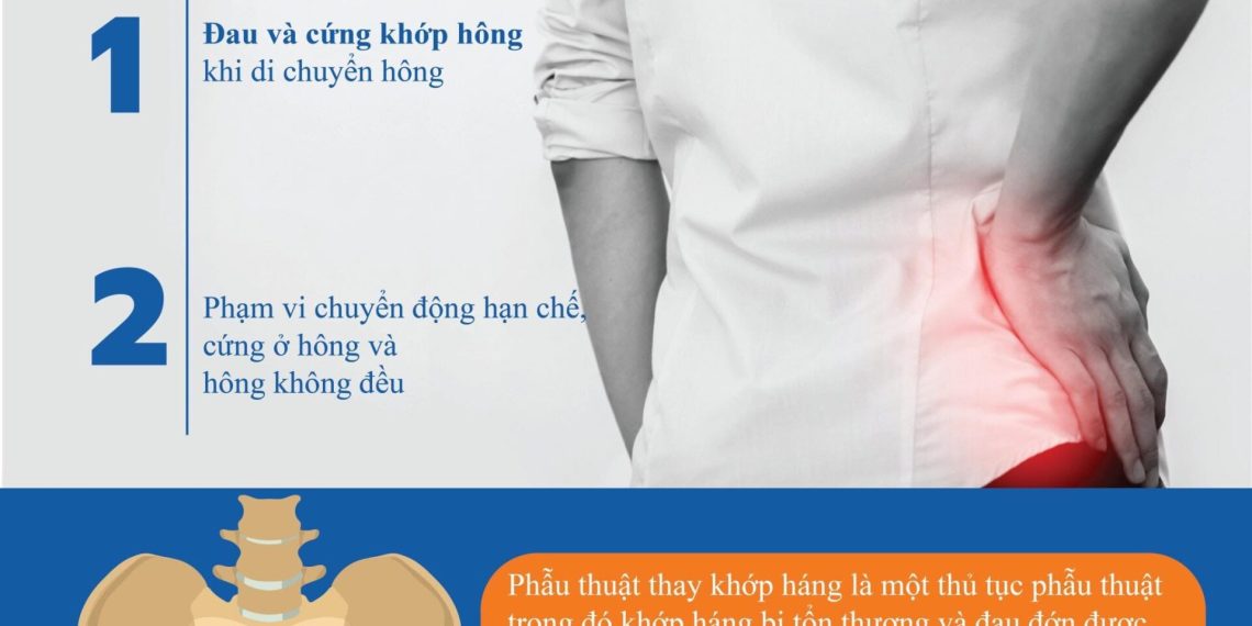 Dấu hiệu bệnh ở khớp hông bạn nên chú ý