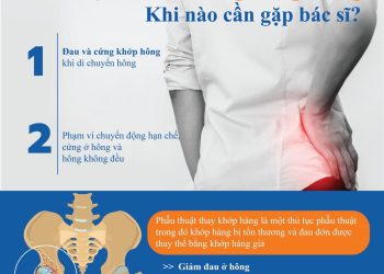 Dấu hiệu bệnh ở khớp hông bạn nên chú ý