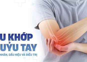 Dấu hiệu bệnh ở khớp khuỷu tay cần biết