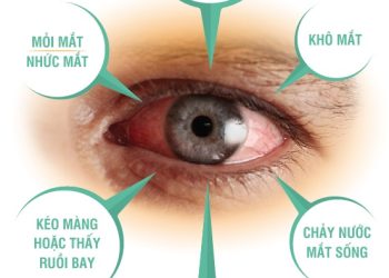 Dấu hiệu bệnh ở mắt ảnh hưởng thị lực