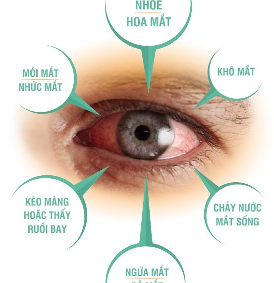 Dấu hiệu bệnh ở mắt ảnh hưởng thị lực