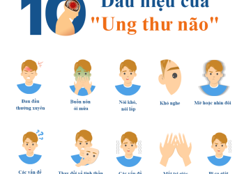 Dấu hiệu bệnh ở não nguy hiểm nhất