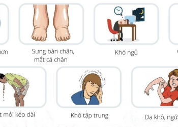 Dấu hiệu bệnh ở thận bạn nên biết