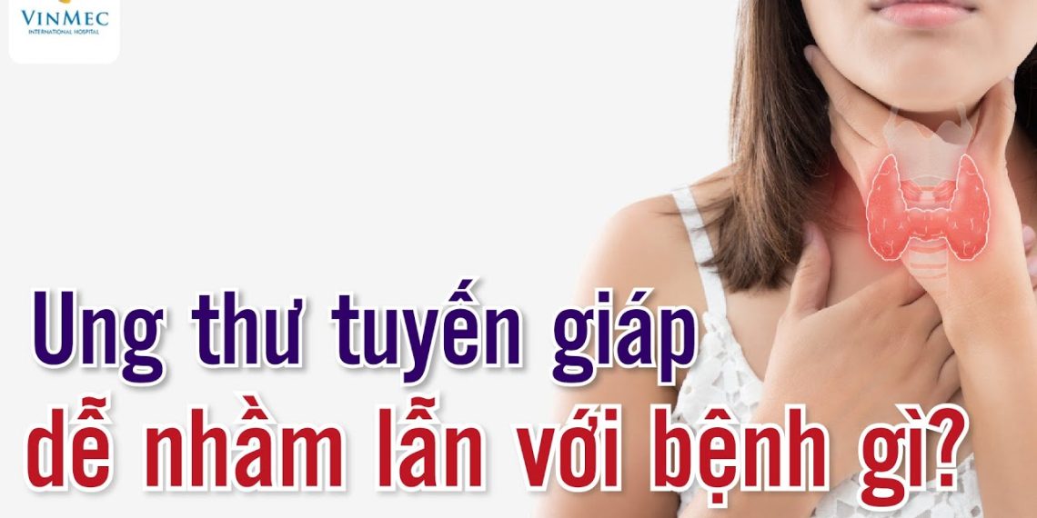 Dấu hiệu bệnh ở tuyến giáp dễ bị nhầm lẫn