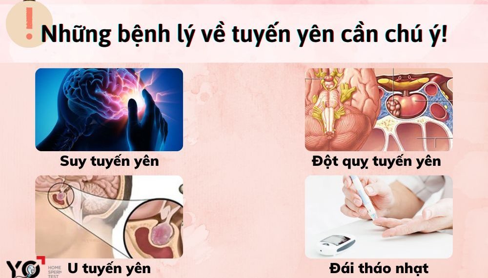 Dấu hiệu bệnh ở tuyến yên cần chú ý