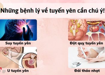 Dấu hiệu bệnh ở tuyến yên cần chú ý