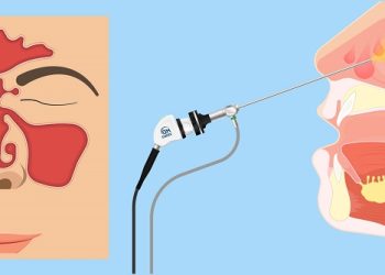 Dấu hiệu bệnh ở vách mũi cần kiểm tra