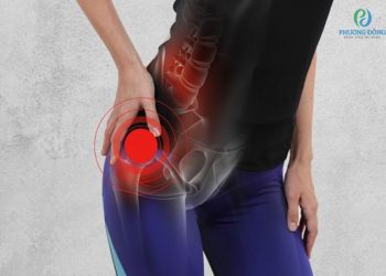 Dấu hiệu bệnh ở xương chậu gây đau nhức