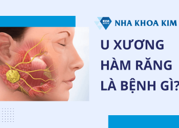 Dấu hiệu bệnh ở xương hàm ảnh hưởng răng miệng