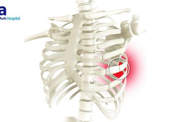 Dấu hiệu bệnh ở xương sườn dễ bị bỏ qua