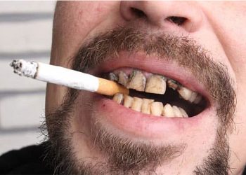 Mẹo giữ răng khỏe cho nam giới hút thuốc