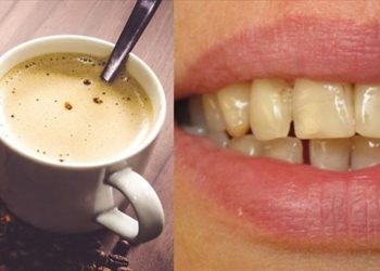 Mẹo giữ răng khỏe cho người hay ăn đồ uống cà phê