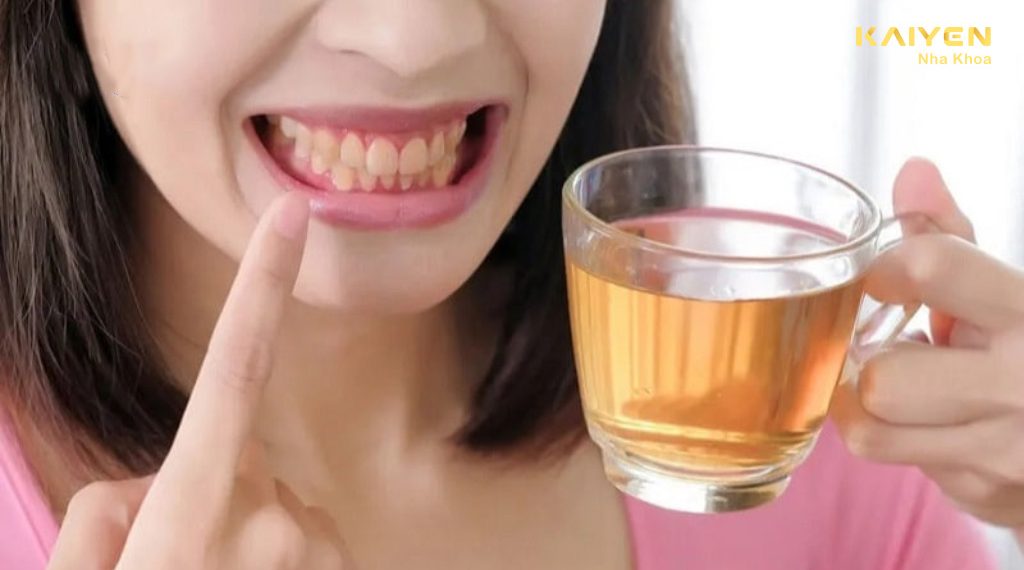 Mẹo giữ răng khỏe cho người thích uống trà