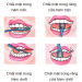 Mẹo giữ răng khỏe cho trẻ em tránh sâu răng